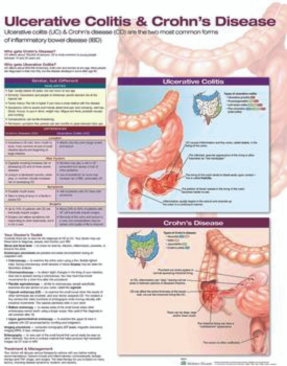 Ulcerative Colitis & Crohn's Disease 