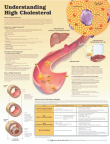 Reference Chart - Understanding High Cholesterol