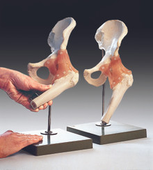  Functional Model of the Hip Joint