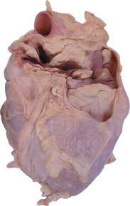 Pig Heart in Pericardium