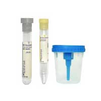 BD Vacutainer Urine Collection Kit with Screw-Cap Cup  58364956-Case