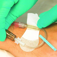 GripLok Securement Device for Medium Universal Catheter and Tubing, 31/2", 1/8"  5/16" Tubing