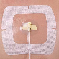 LVAD 6 Inches by 6 Inches Dressing With Universal Tape Strip  EELVAD66UXT-Each