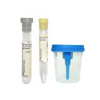 BD Vacutainer Urine Collection Kit with Screw-Cap Cup  58364956-Each