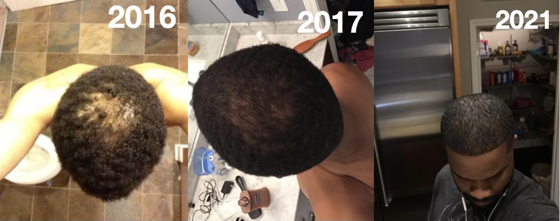 before after 6 years on the product