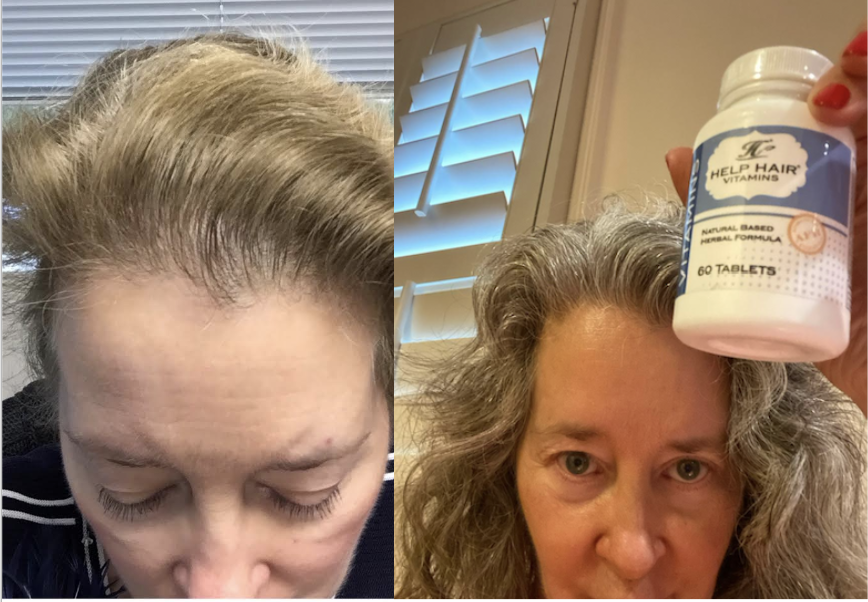 before-after-help-hair-products.png