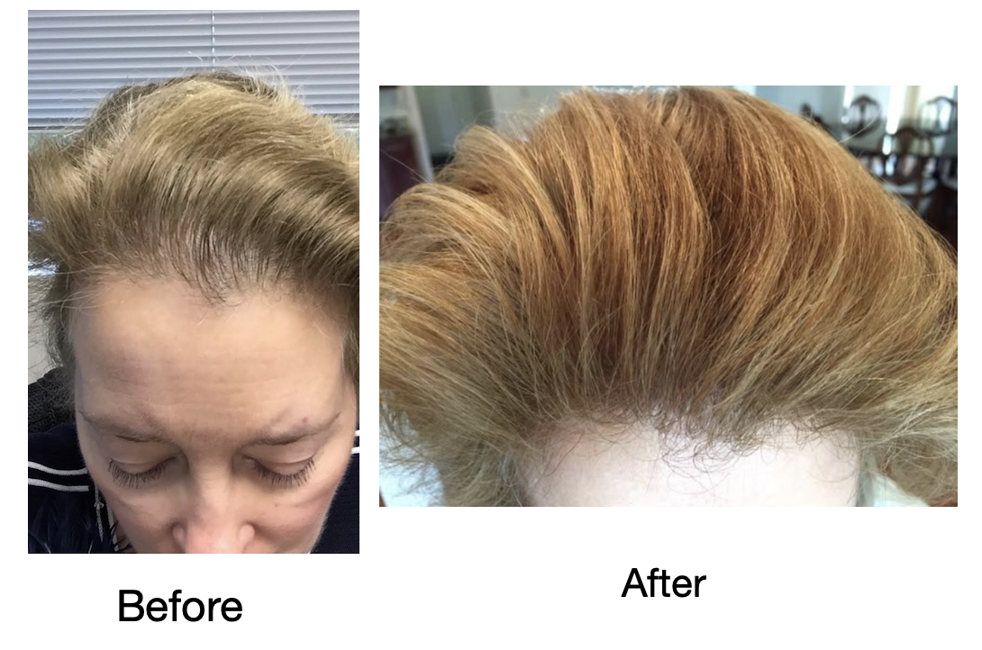 Help Hair Shake and Hair Vitamins for menopausal women  with thinning hair