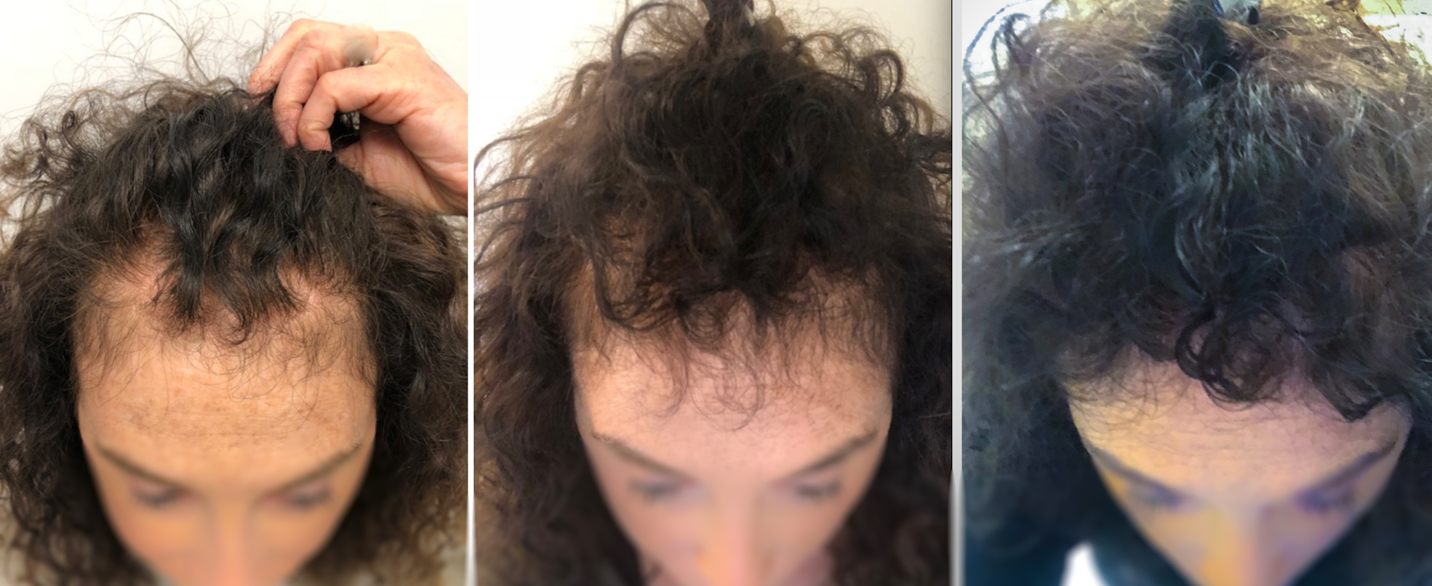 help hair shake 1-9 months