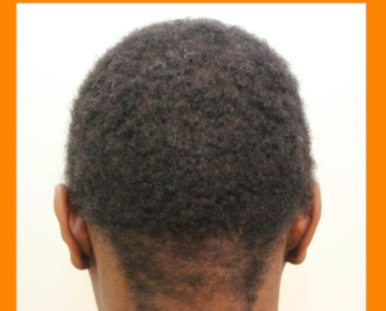 African American Hair Growth Products For Men Hairstyles Idea