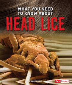 What You Need to Know about Head Lice - 9781491482469 by Nancy Dickmann, 9781491482469