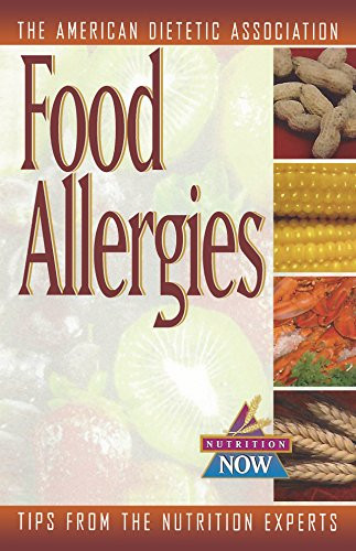 Food Allergies (The Nutrition Now Series) by The American Dietetic Association, 9780471347149