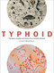 Typhoid (The past, present, and future of an ancient disease) by Claas Kirchhelle, 9781785513831