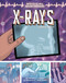 X-Rays (A Graphic History) by Rachael L. Thomas, Josep Rural, 9781541581548