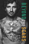 Beyond the Scars (Life is Defined by Who You Are, Not Your Circumstances) by Matt Manzari, 9781951492281