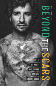 Beyond the Scars (Life is Defined by Who You Are, Not Your Circumstances) by Matt Manzari, 9781951492281