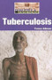Tuberculosis - 9781590189689 by Toney Allman, 9781590189689
