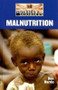 Malnutrition - 9781590186770 by Don Nardo, 9781590186770