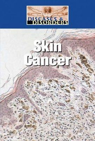 Skin Cancer - 9781590189313 by Bonnie Juettner, 9781590189313