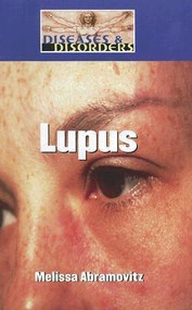 Lupus - 9781590189993 by Melissa Abramovitz, 9781590189993