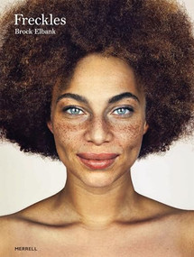 Freckles - 9781858946719 by Brock Elbank, 9781858946719