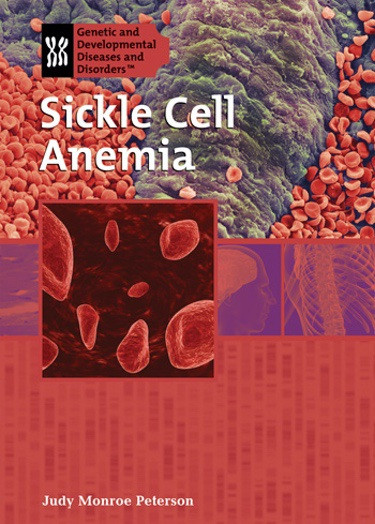 Sickle Cell Anemia by Judy Monroe Peterson, 9781404218512