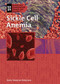Sickle Cell Anemia by Judy Monroe Peterson, 9781404218512