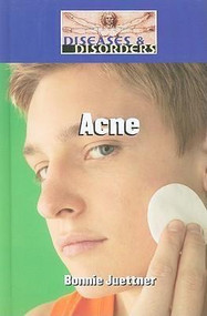Acne by Bonnie Juettner, 9781420502152