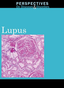 Lupus - 9780737747898 by Hayley Mitchell Haugen