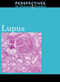 Lupus - 9780737747898 by Hayley Mitchell Haugen