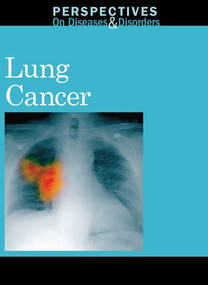 Lung Cancer - 9780737750027 by Jacqueline Langwith, 9780737750027