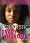 Polycystic Ovary Syndrome by Frances E. Ruffin, 9781448845767