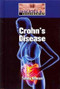 Crohn's Disease by Toney Allman, 9781420506914