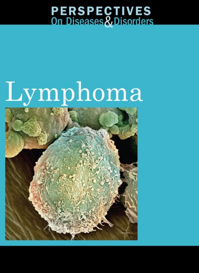 Lymphoma by Arthur Gillard, 9780737757781