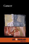 Cancer - 9780737755589 by Jacqueline Langwith, 9780737755589