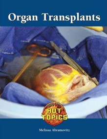 Organ Transplants - 9781420508161 by Melissa Abramovitz, 9781420508161