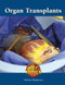 Organ Transplants - 9781420508161 by Melissa Abramovitz, 9781420508161
