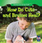 How Do Cuts and Bruises Heal? by Gary Frick, 9781482402346