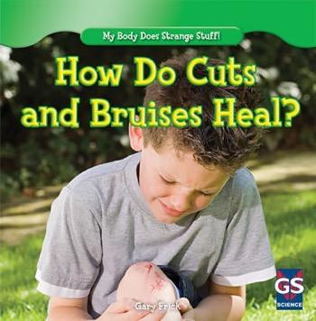 How Do Cuts and Bruises Heal? - 9781482402414 by Gary Frick, 9781482402414
