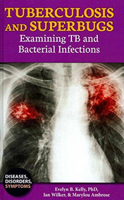 Tuberculosis and Superbugs (Examining TB and Bacterial Infections) by Ian Wilker, Marylou Ambrose, 9781622930852