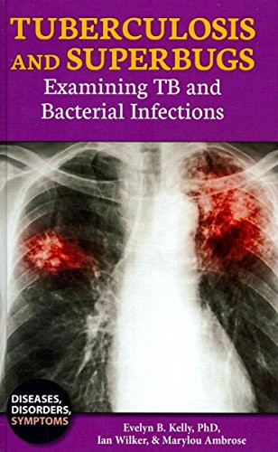 Tuberculosis and Superbugs (Examining TB and Bacterial Infections) by Ian Wilker, Marylou Ambrose, 9781622930852