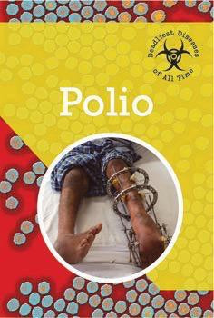 Polio - 9781502600882 by Timothy Grayson-Jones, 9781502600882