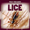 Lice - 9781499407570 by Nick Christopher, 9781499407570