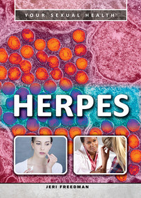 Herpes - 9781499460544 by Jeri Freedman, 9781499460544