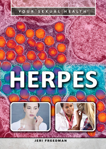 Herpes - 9781499460544 by Jeri Freedman, 9781499460544