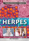 Herpes - 9781499460544 by Jeri Freedman, 9781499460544