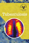 Tuberculosis - 9781502606464 by Randall McPartland, 9781502606464