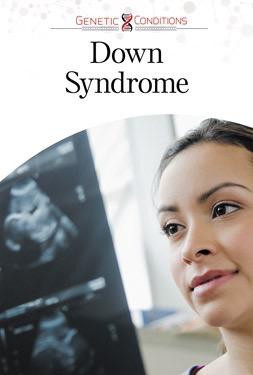 Down Syndrome - 9781502609380 by Petra Miller, 9781502609380