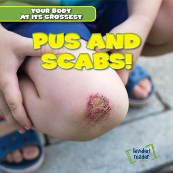 Pus and Scabs! - 9781482464931 by Melvin Hightower, 9781482464931