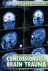 Concussions and Other Brain Trauma by Ryan Nagelhout, 9781534561274