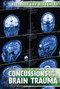 Concussions and Other Brain Trauma by Ryan Nagelhout, 9781534561274
